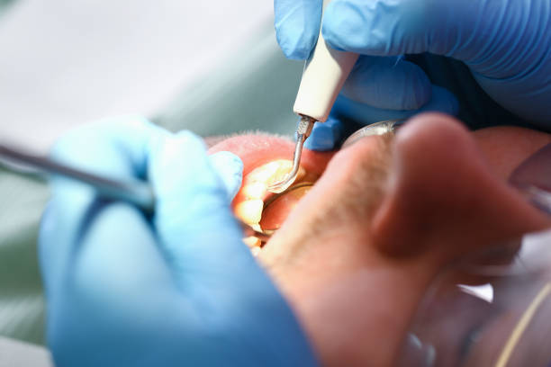 Best Urgent Dental Care for Toothaches in Vandenberg Village, CA
